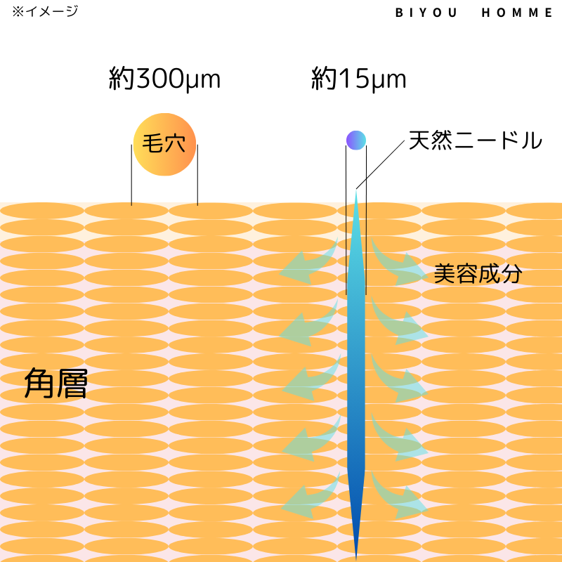 VTリードルショット天然ニードル解説